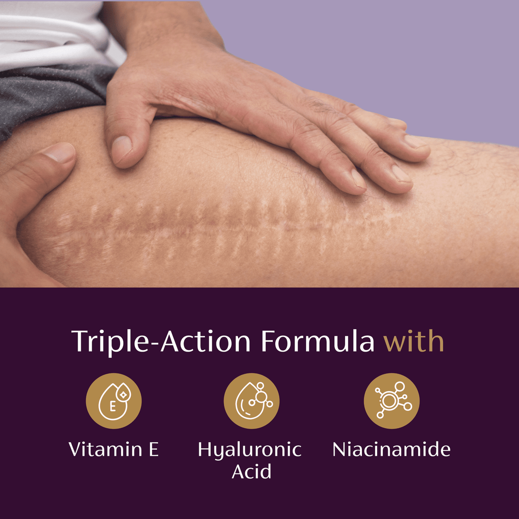 Mederma Scar Serum – Triple-Action Formula with Vitamin E, Hyaluronic Acid & Niacinamide – Clinically Shown to Reduce Old Scars,  1 Fl. Oz.