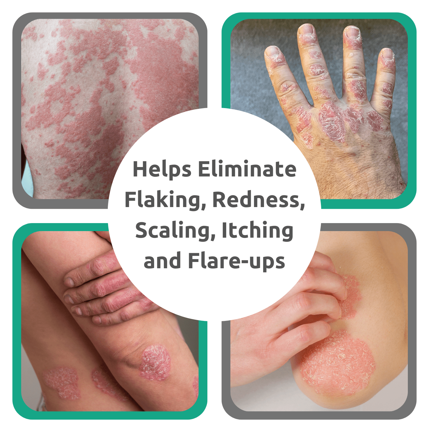 Dr. Blaine's Revitaderm Psoriasis Formula,  4 oz