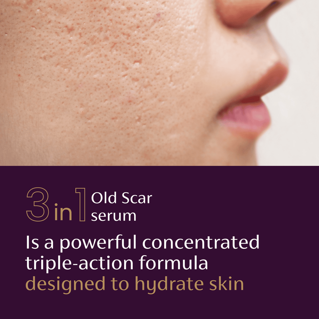 Mederma Scar Serum – Triple-Action Formula with Vitamin E, Hyaluronic Acid & Niacinamide – Clinically Shown to Reduce Old Scars,  1 Fl. Oz.